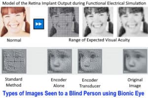 What is Bionic Eye and How Does it Work? - Electrical Technology